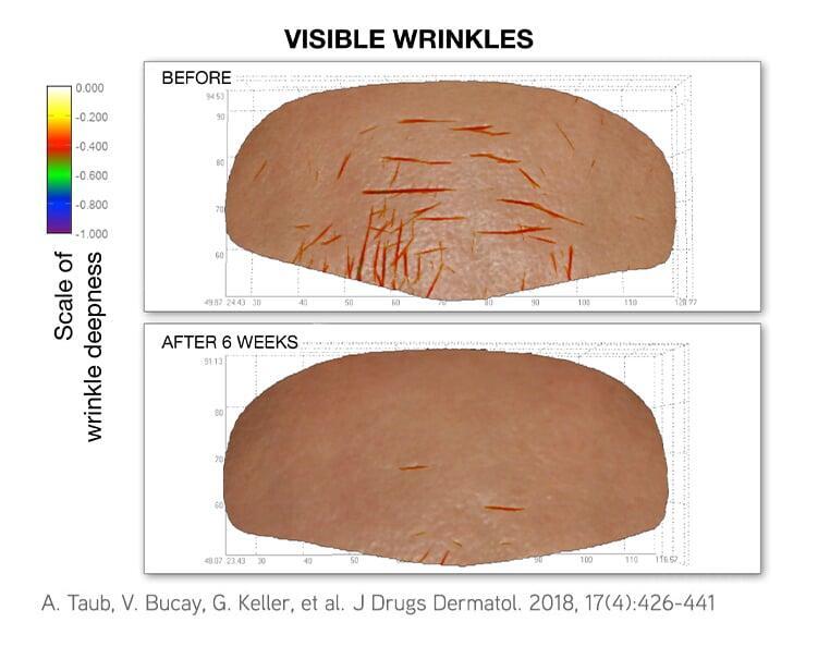 Wrinkle reduction — DefenAge clinical study